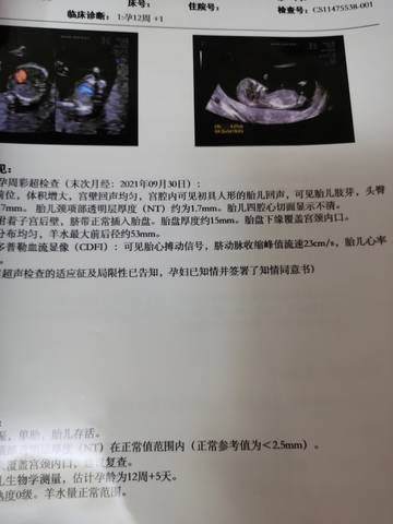 journal_insert_pic_1685465081