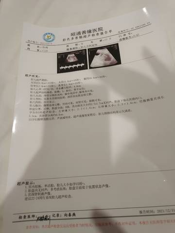 journal_insert_pic_1689680569