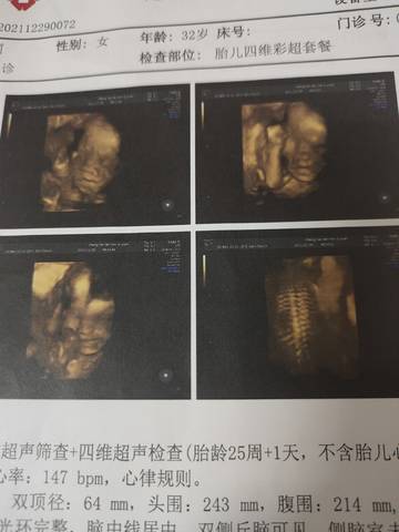 journal_insert_pic_1688546260