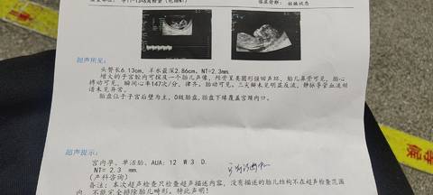 journal_insert_pic_1688635718