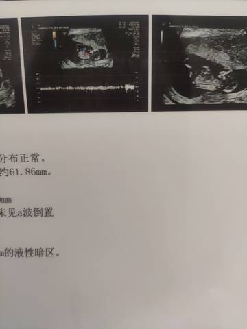journal_insert_pic_1689087915