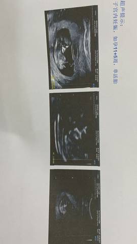 journal_insert_pic_1682766062