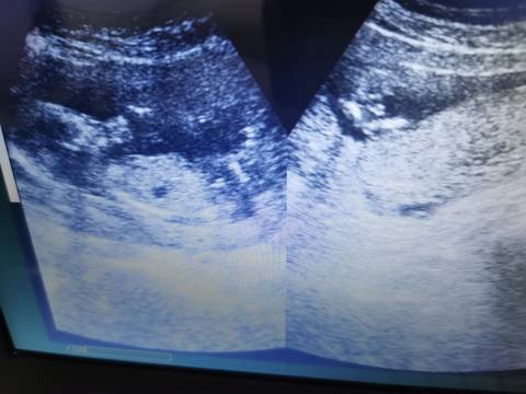 journal_insert_pic_1690280590