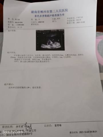 journal_insert_pic_1688139916