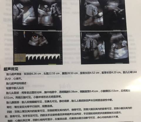 journal_insert_pic_1682642756