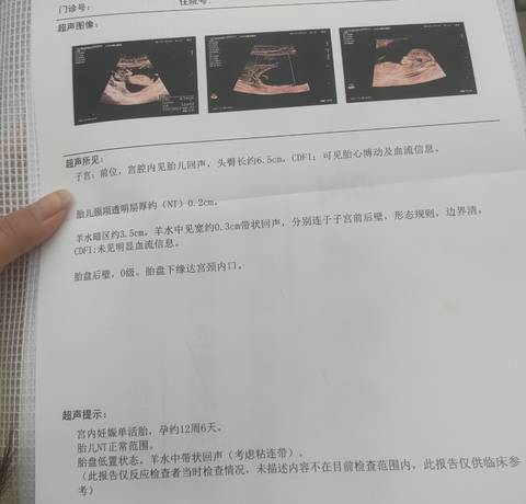 journal_insert_pic_1676270884