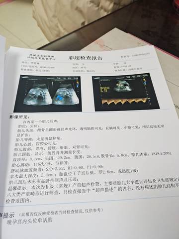 journal_insert_pic_1688851748