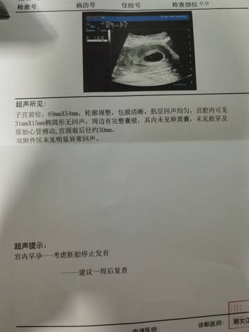 journal_insert_pic_1674935252