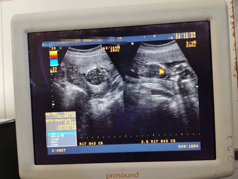 journal_insert_pic_1674443939