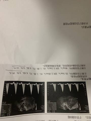 journal_insert_pic_1685510455