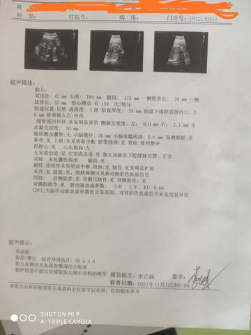 journal_insert_pic_1675414578