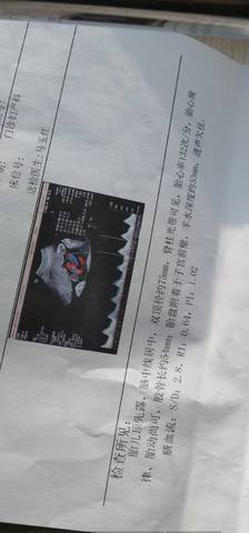 journal_insert_pic_1679916651