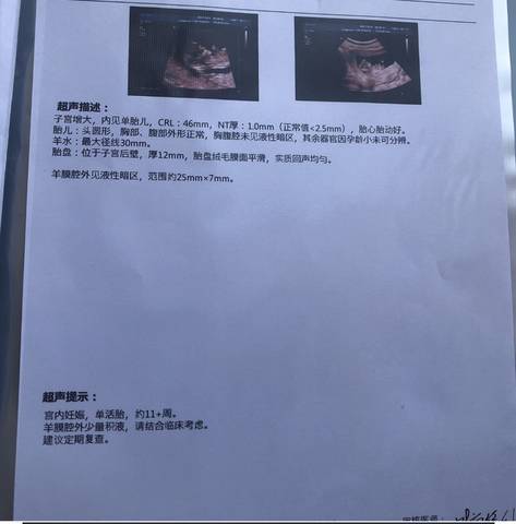 journal_insert_pic_1687977317