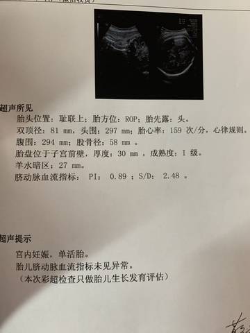 journal_insert_pic_1688669417