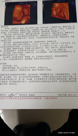 journal_insert_pic_1675586379