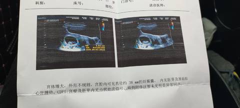 journal_insert_pic_1680987648