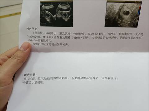 journal_insert_pic_1676605856