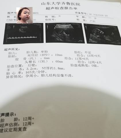 journal_insert_pic_1678490573