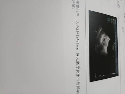 journal_insert_pic_1686137674