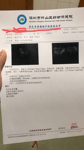 journal_insert_pic_1682087680