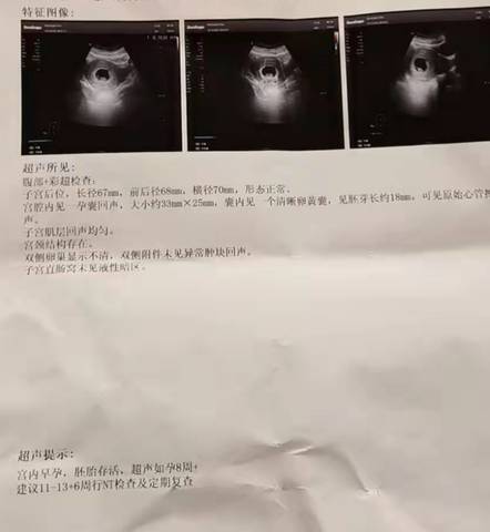 journal_insert_pic_1679874878