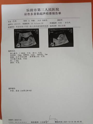 journal_insert_pic_1680973979