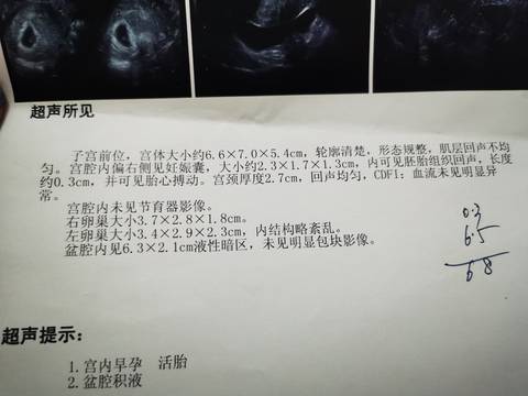 journal_insert_pic_1690130220