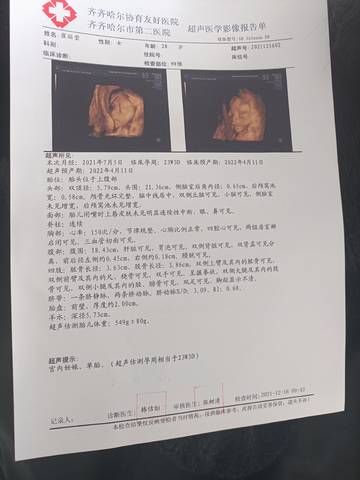 journal_insert_pic_1682456022