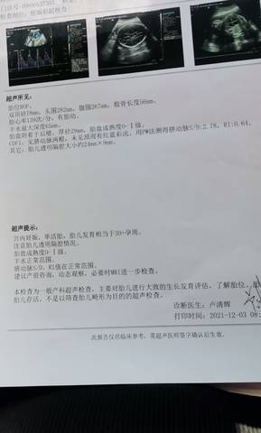journal_insert_pic_1673061701
