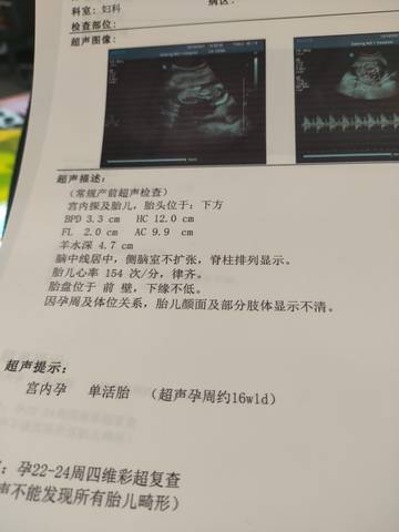 journal_insert_pic_1677786059