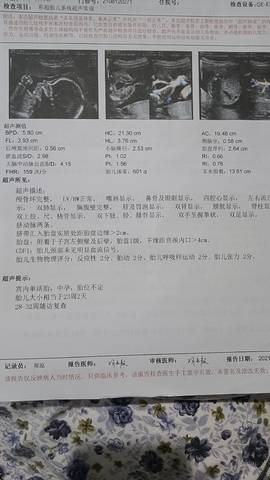 journal_insert_pic_1686577596