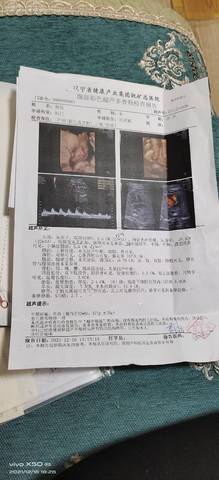 journal_insert_pic_1681386249