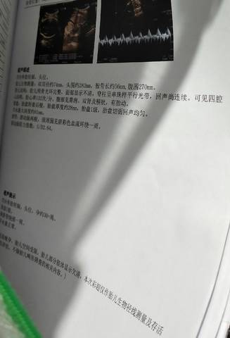 journal_insert_pic_1676460501