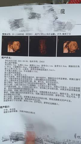 journal_insert_pic_1719473864