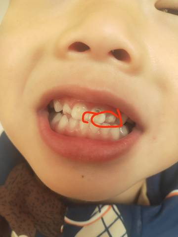 journal_insert_pic_1675923244