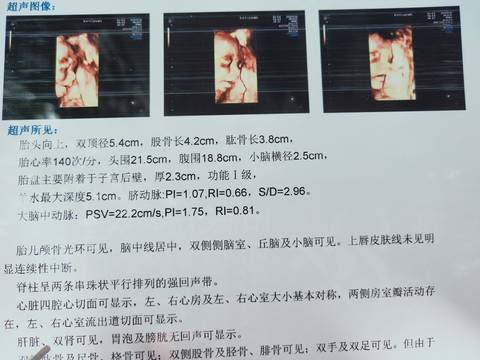 journal_insert_pic_1685640846