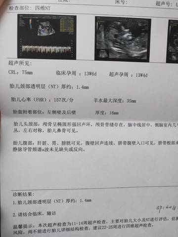 journal_insert_pic_1677463358