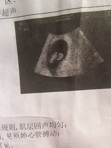 journal_insert_pic_1688227447