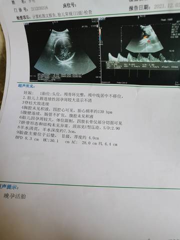 journal_insert_pic_1684390400