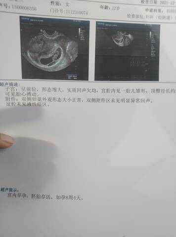 journal_insert_pic_1689600655