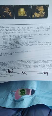 journal_insert_pic_1674221491