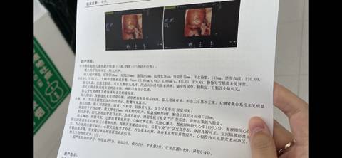 journal_insert_pic_1682124423