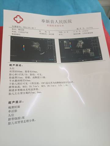 journal_insert_pic_1676802623