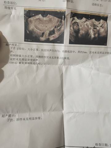 journal_insert_pic_1688406929