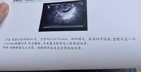 journal_insert_pic_1682420825