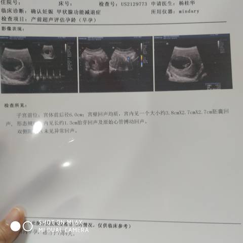 journal_insert_pic_1684029049