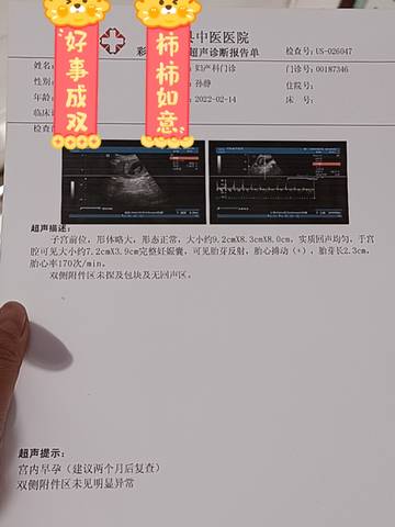 journal_insert_pic_1719578988