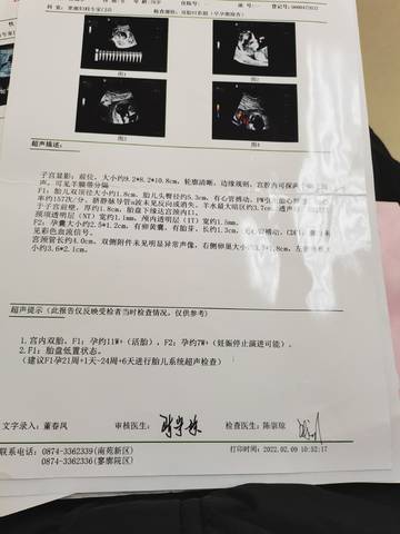 journal_insert_pic_1719425817