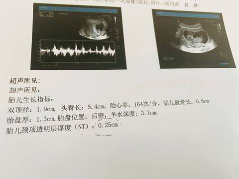 journal_insert_pic_1679939059