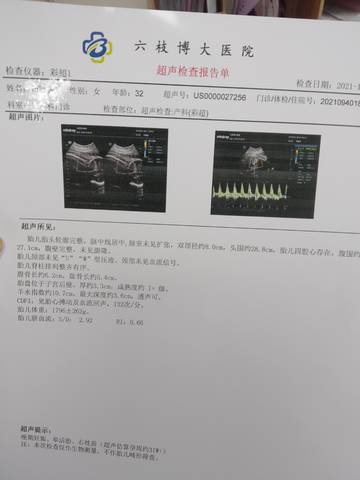 journal_insert_pic_1677353022